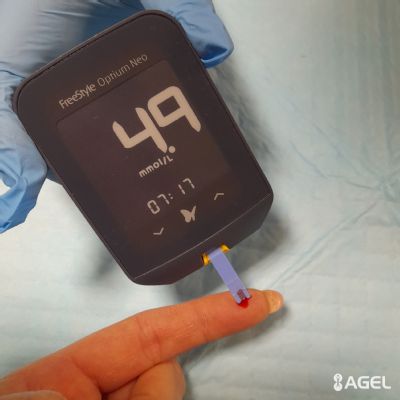Nemocnica AGEL Zlaté Moravce upozorňuje na rastúci problém diabetu a význam zdravého životného štýlu
